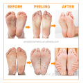 Pure nourishing foot peel mask gel foot skin